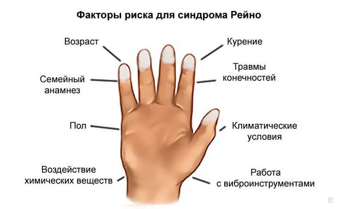 Лечение нарушения кровообращения в кистях рук