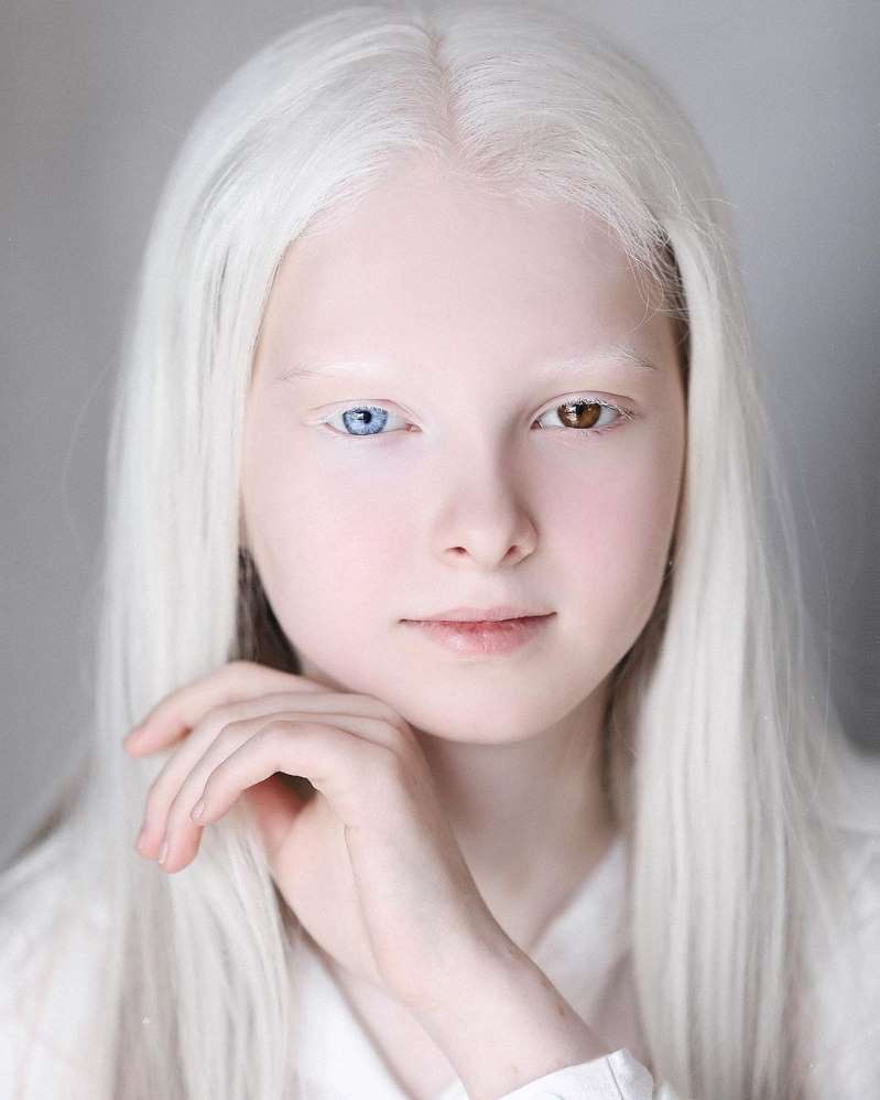 Natalie albino husband