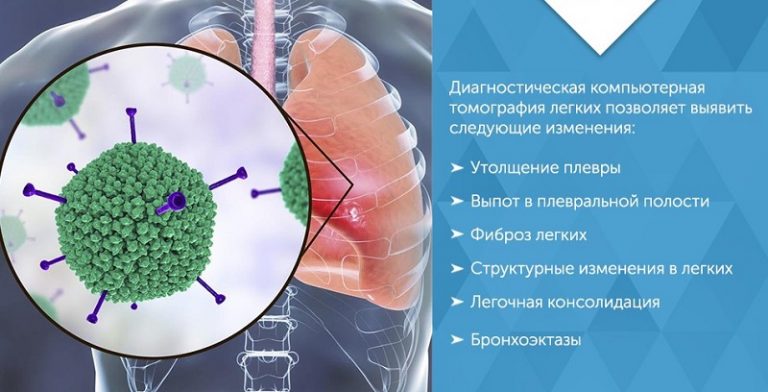 Как делают кт легких взрослого человека фото