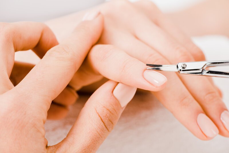 Почему возникают заусенцы на пальцах: причины и способы предотвращения