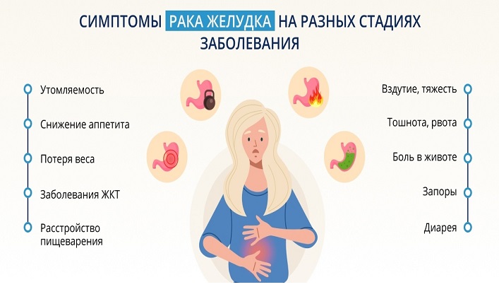 Симптомы рака на ранней стадии. Беременная женщина. Может ли повышенное газообразование быть признаком онкологии. Для пищеварения при беременности на основе.