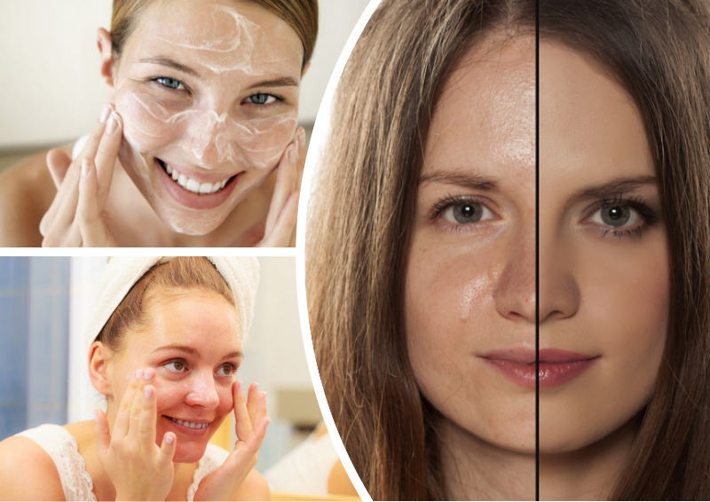 Как правильно ухаживать за жирной кожей лица и избавиться от блеска