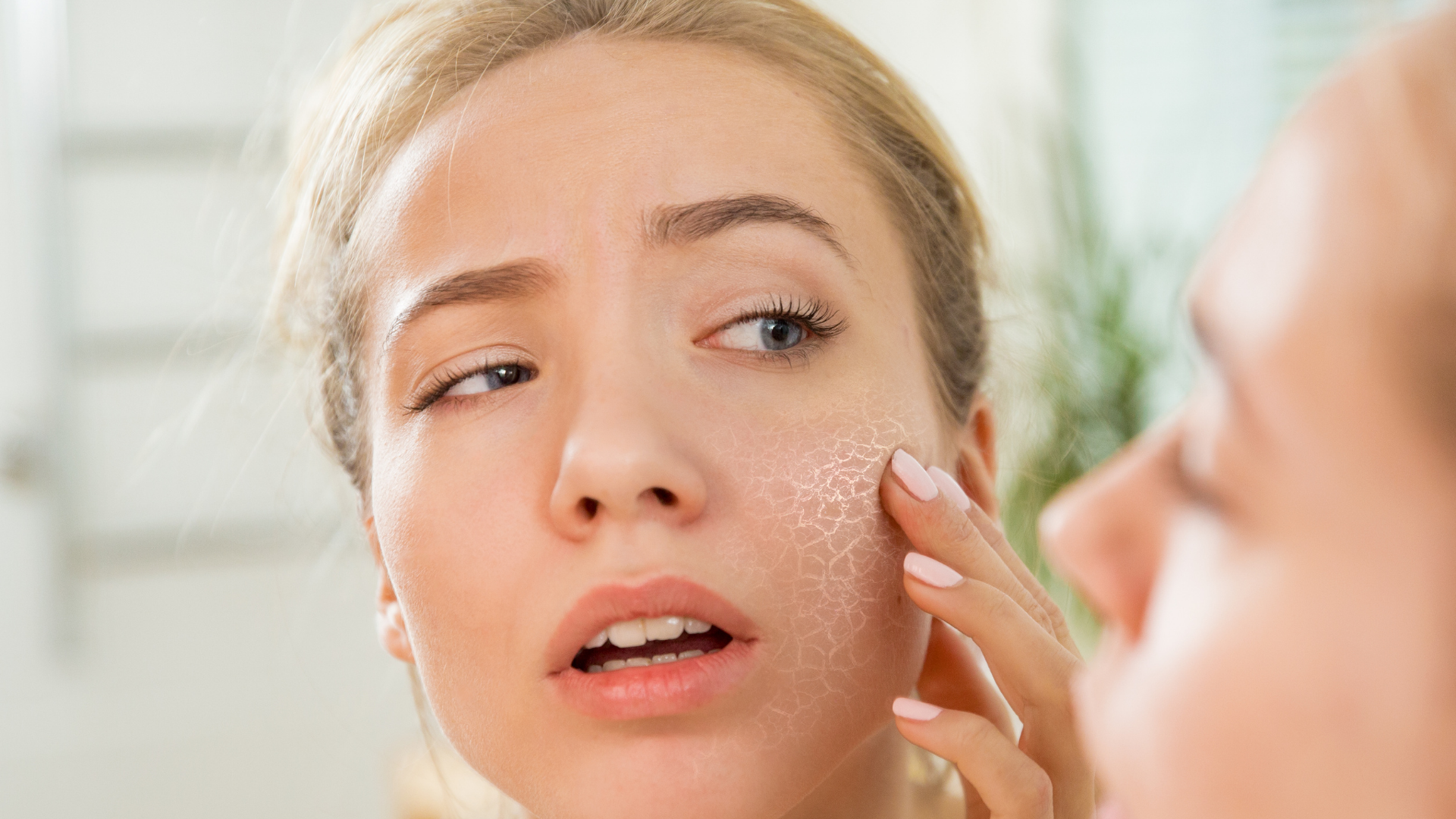 Причины сухости кожи лица, что делать когда она начинает шелушиться